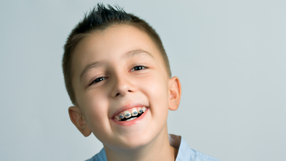 Children Orthodontics @ New Millennium Dental