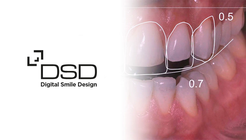 Digital Smile Design Ceritfied Clinic