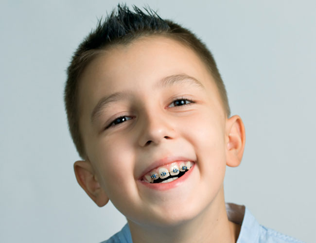 Will My Child Actually Need Braces?