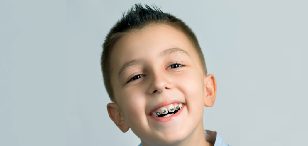 Will My Child Need Braces?