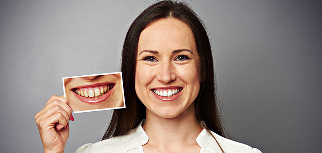 How To Get Rid Of Yellow Teeth?