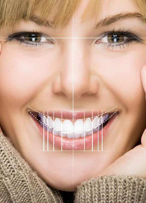 Is Digital Smile Design Right for You?