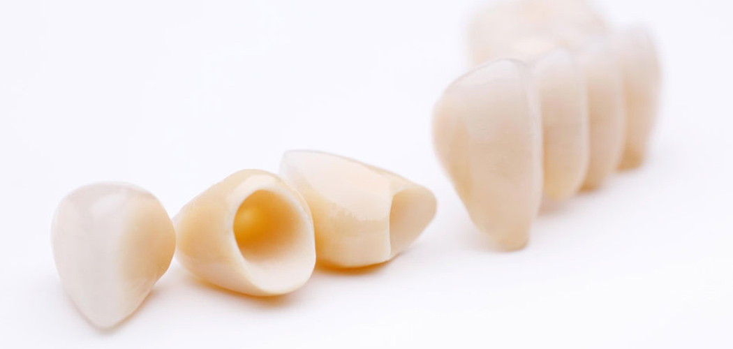 Dental Crowns in Bentleigh