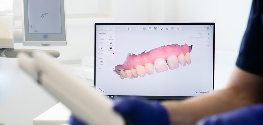 Digital Smile Design Melbourne