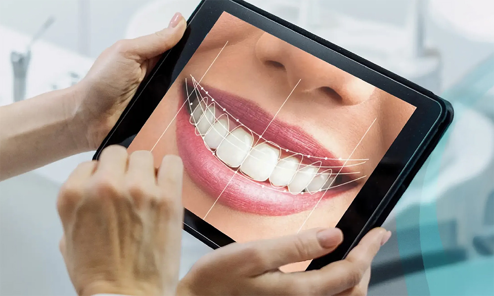 Understanding DSD Limitations