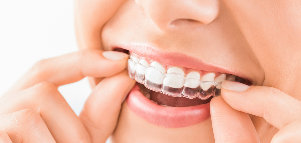 Is Invisalign right for you?