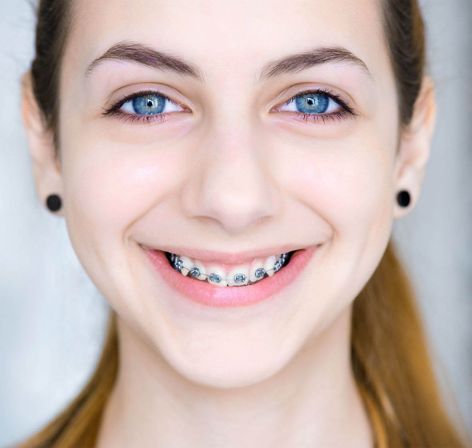 Children & Adult Orthodontics @ New Millennium Dental