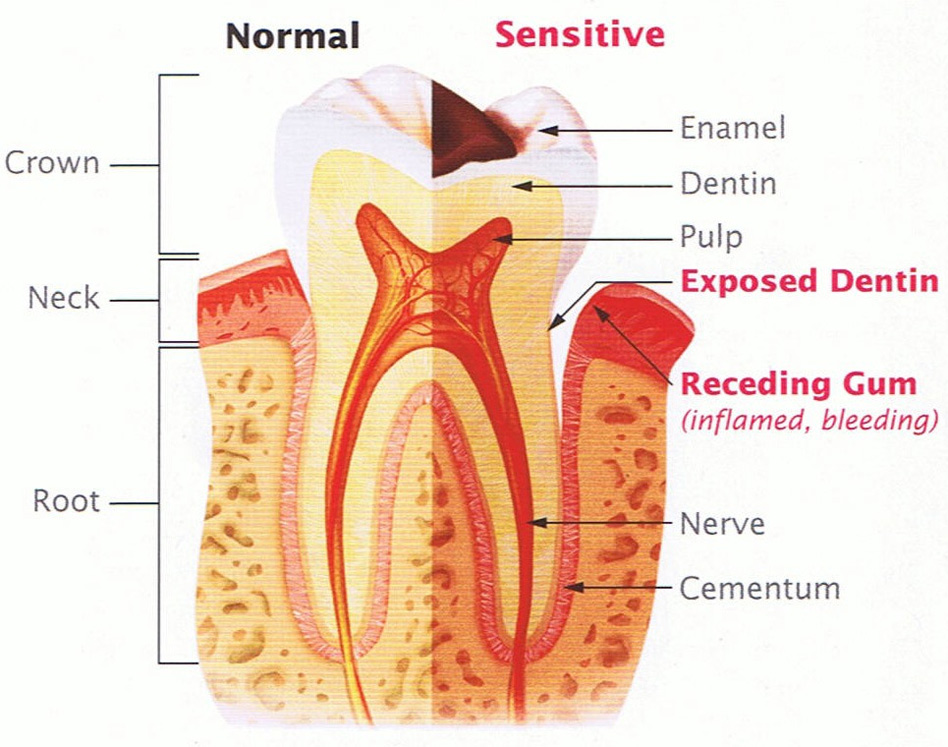 The causes of tooth sensitivity